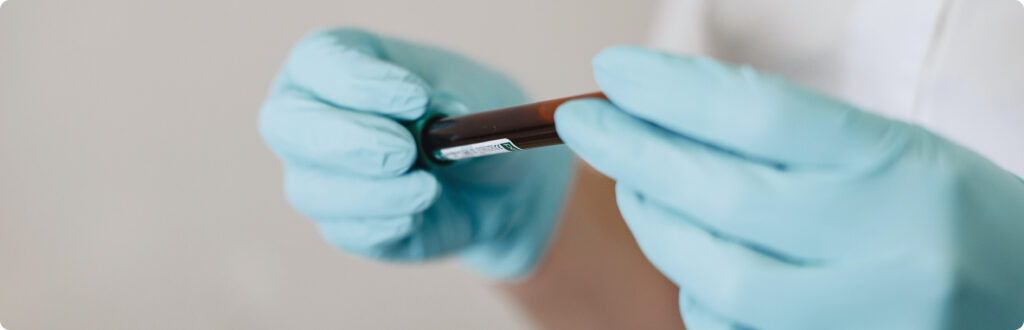 Conservation de sang en laboratoire